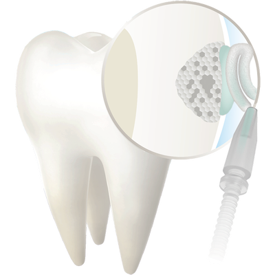 Curodont repair fluoride plus