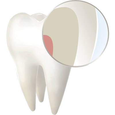 Healthy tooth